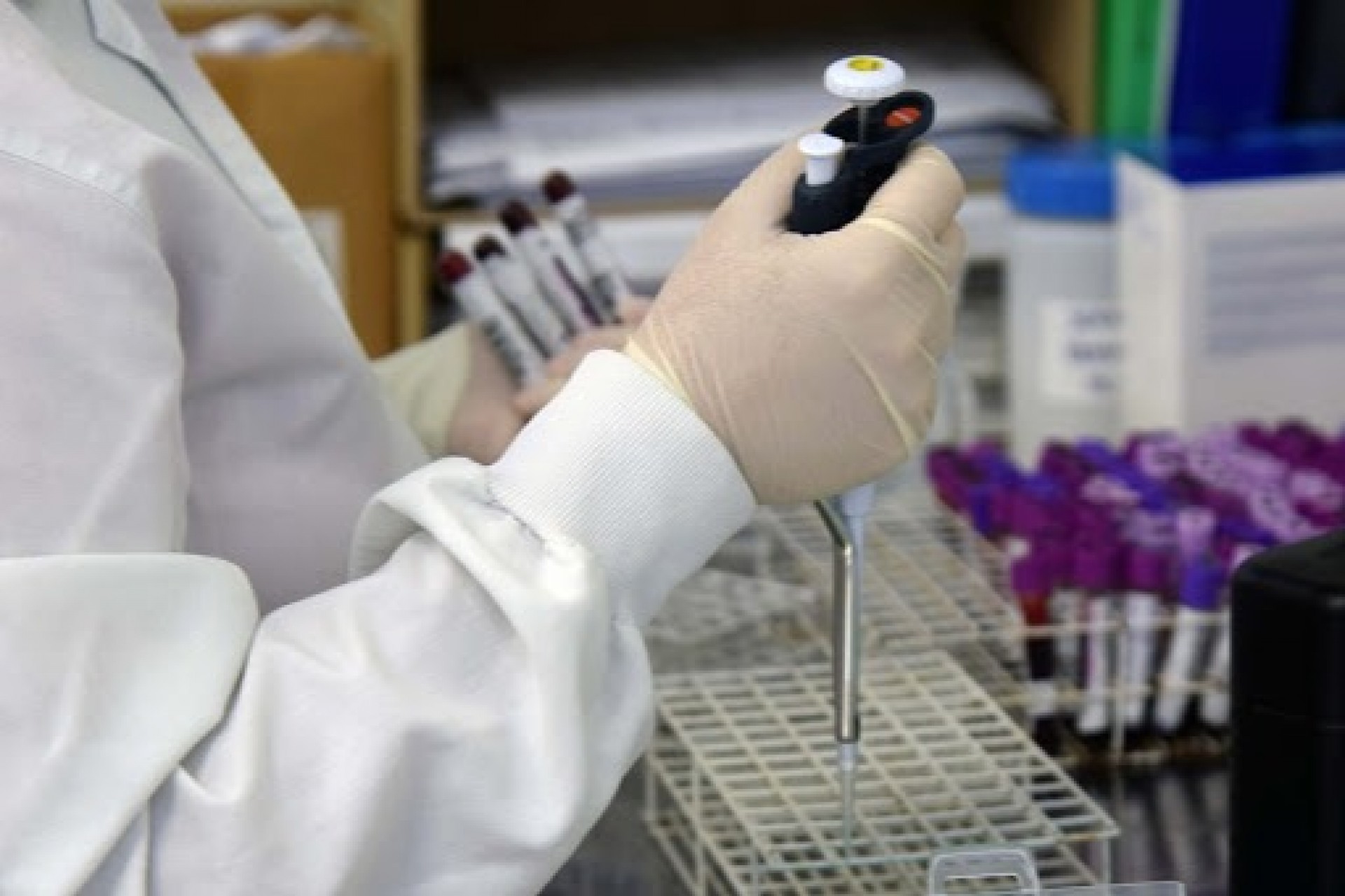 Laboratório Central do Estado do Paraná fará diagnóstico do novo coronavírus