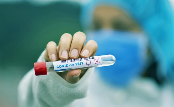 Confirmado segundo caso de coronavírus em Itaipulândia