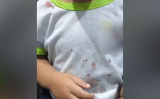 Criança chega à CMEI com ferimentos e camisa com manchas de sangue, e polícia prende padrasto