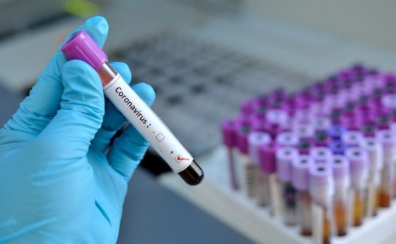 Mulher de 42 anos é o primeiro caso confirmado de Coronavírus em Cascavel