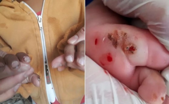 Pais são presos suspeitos de abandonar filho de 2 anos encontrado com vários machucados pelo corpo